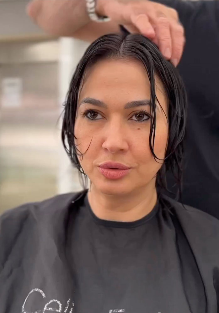 haircut stories, tiktok hair, scene hair, hair clinic, hair restoration, hairlosstalk, hair clinic near me, hair loss treatment, hair transplant near me, prom hairstyles,