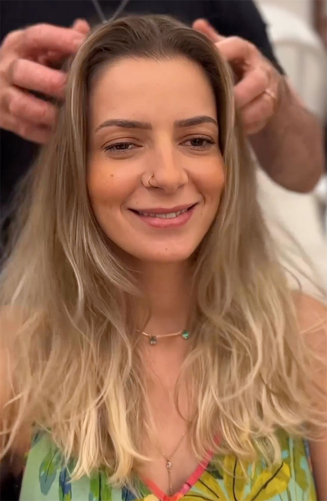 haircut stories, tiktok hair, scene hair, hair clinic, hair restoration, hairlosstalk, hair clinic near me, hair loss treatment, hair transplant near me, prom hairstyles,