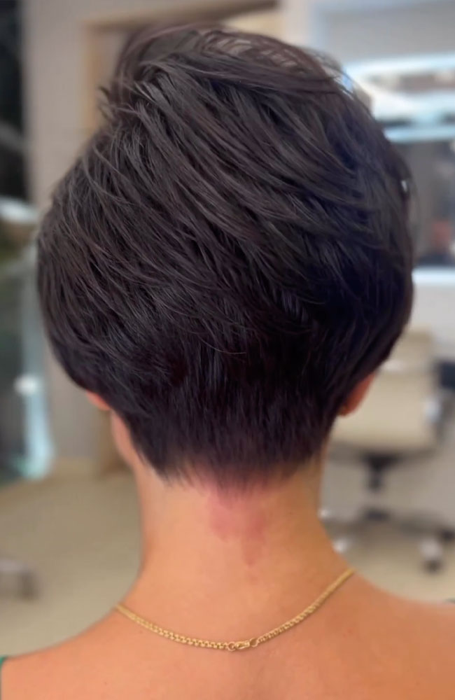 haircut stories, tiktok hair, scene hair, hair clinic, hair restoration, hairlosstalk, hair clinic near me, hair loss treatment, hair transplant near me, prom hairstyles,