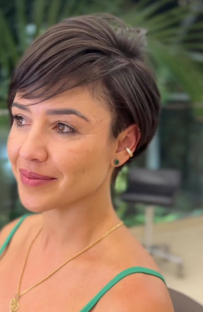 haircut stories, tiktok hair, scene hair, hair clinic, hair restoration, hairlosstalk, hair clinic near me, hair loss treatment, hair transplant near me, prom hairstyles,