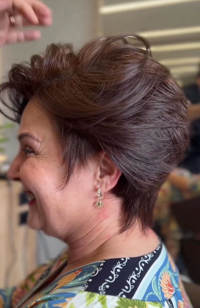 haircut stories, tiktok hair, scene hair, hair clinic, hair restoration, hairlosstalk, hair clinic near me, hair loss treatment, hair transplant near me, prom hairstyles,