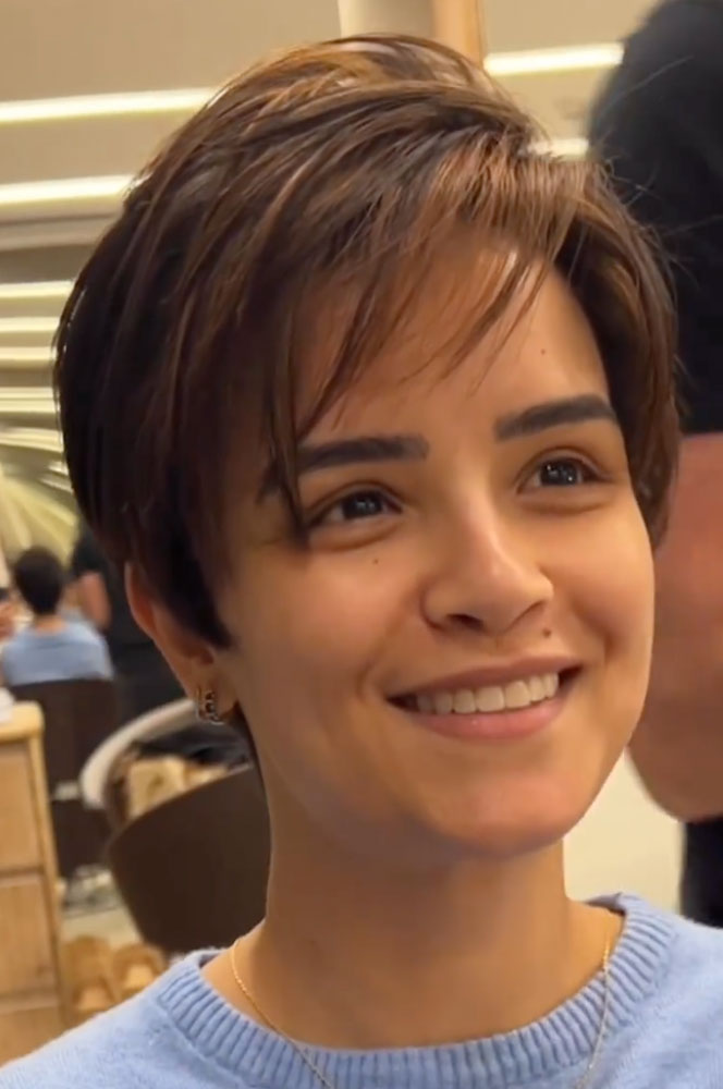 haircut stories, tiktok hair, scene hair, hair clinic, hair restoration, hairlosstalk, hair clinic near me, hair loss treatment, hair transplant near me, prom hairstyles,