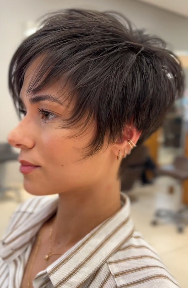haircut stories, tiktok hair, scene hair, hair clinic, hair restoration, hairlosstalk, hair clinic near me, hair loss treatment, hair transplant near me, prom hairstyles,